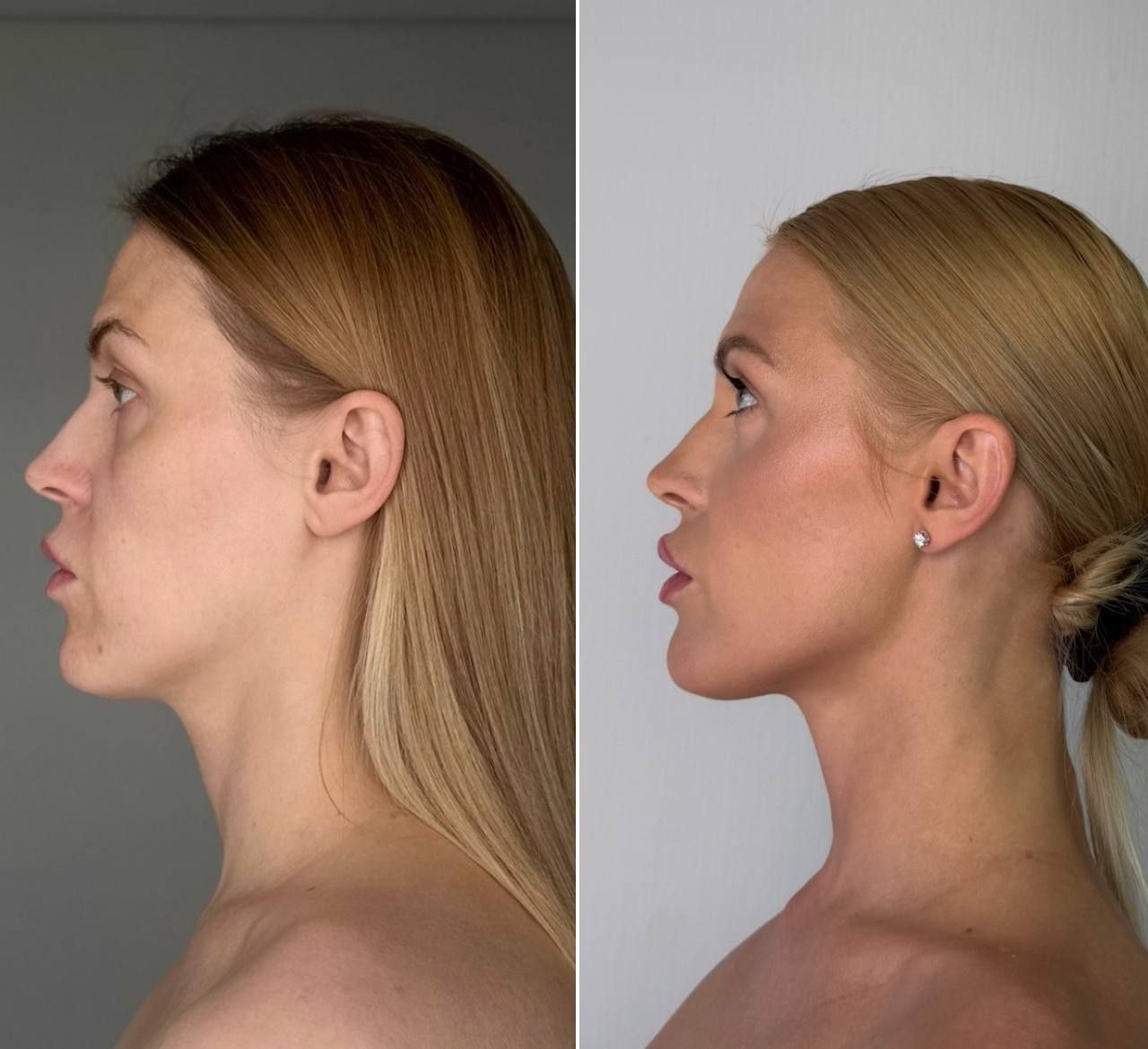 Student transformation before and after 18