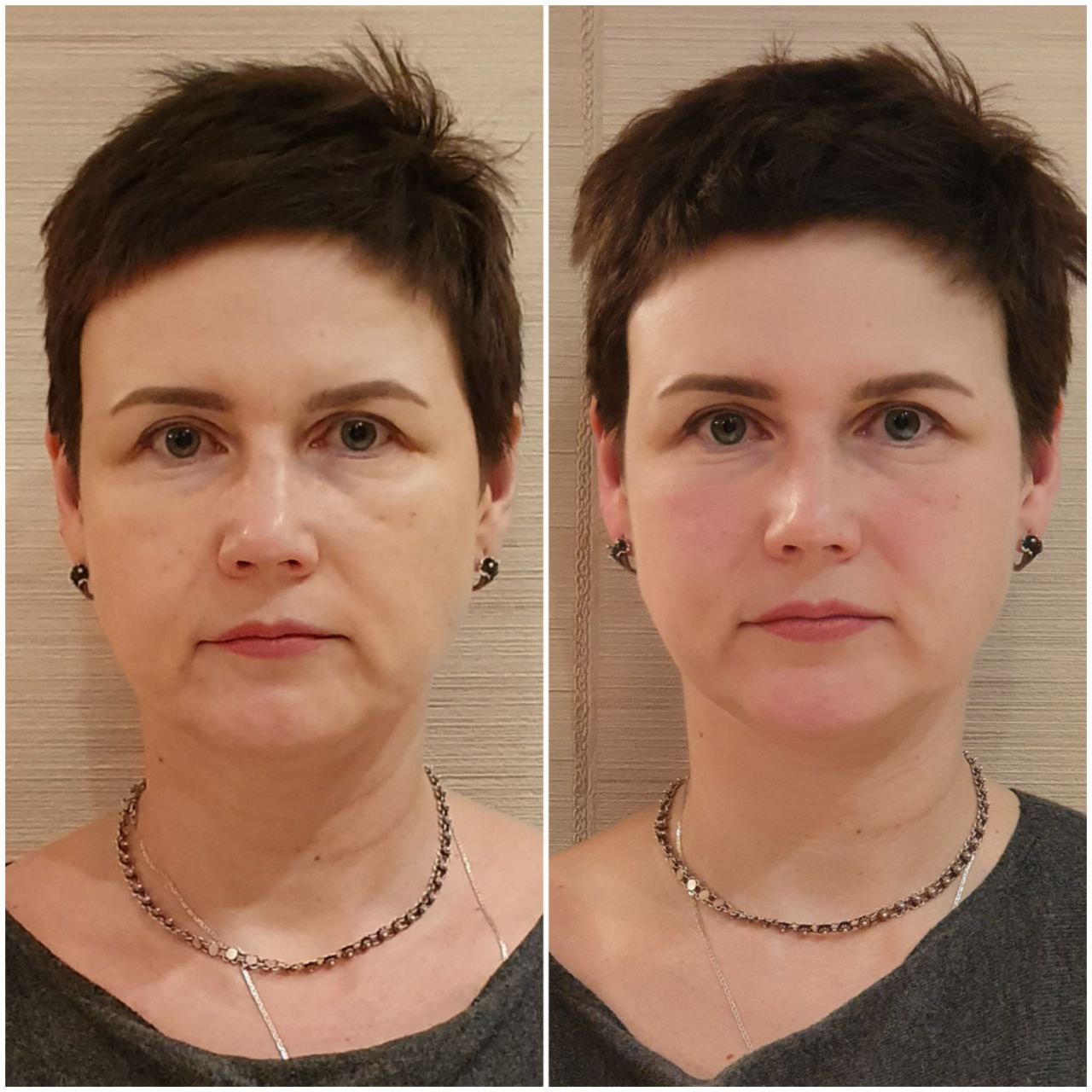Student transformation before and after 11