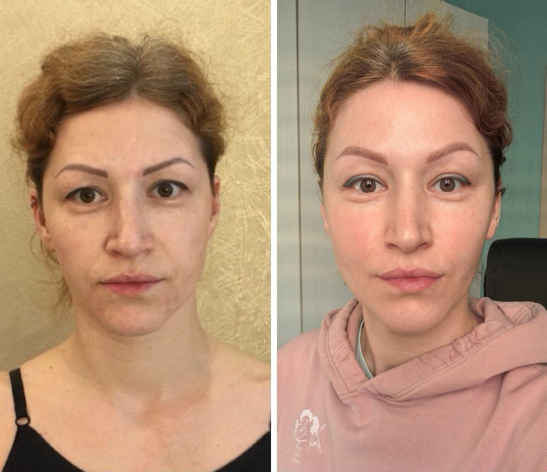 Student transformation before and after 20